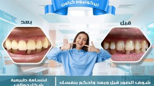 اسنانك عنوانك